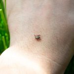 tick crawling on mans hand