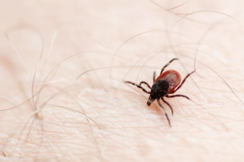 Closeup of dog tick on human skin surface.